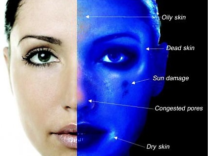 Skin analyzer